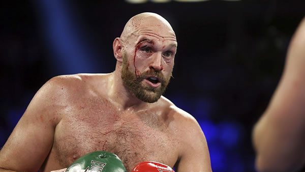 Tyson Fury vs. Dillian Whyte Fight Odds & Picks